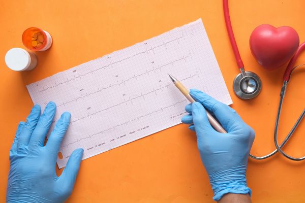 Découvrez un modèle de plan de maîtrise sanitaire sur mesure
